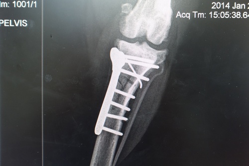 Digital Radiology